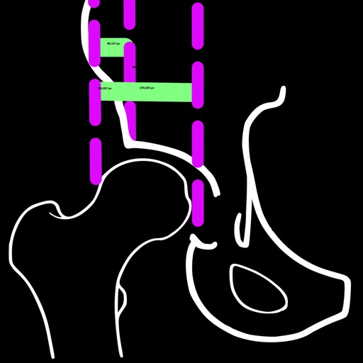 reimersindexapp