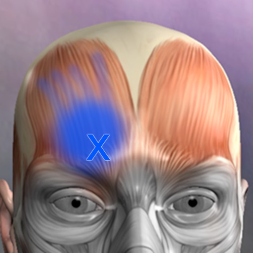 muscle trigger points