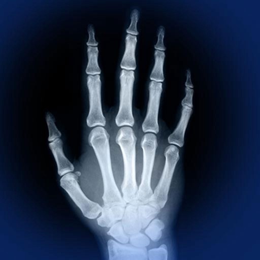skeletal anatomy 3d