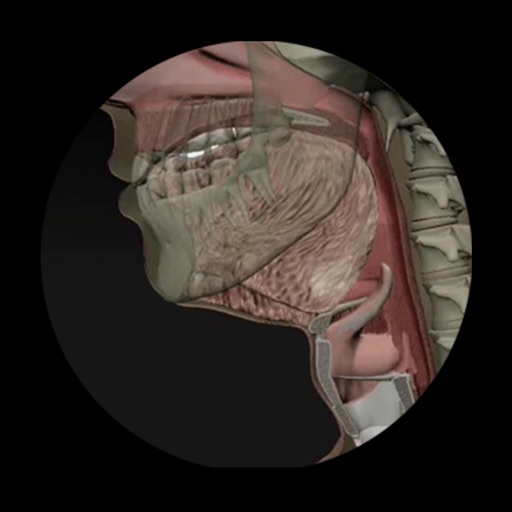 dysphagia