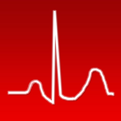 ecgsource