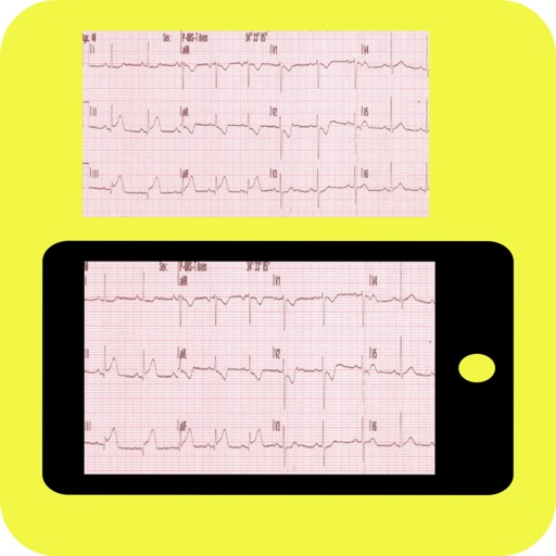 ecg reader