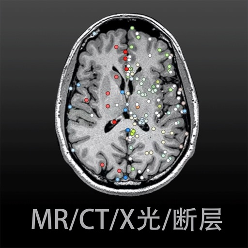 影像解剖图谱-断层·ct·mr·造影·x线·dicom阅片