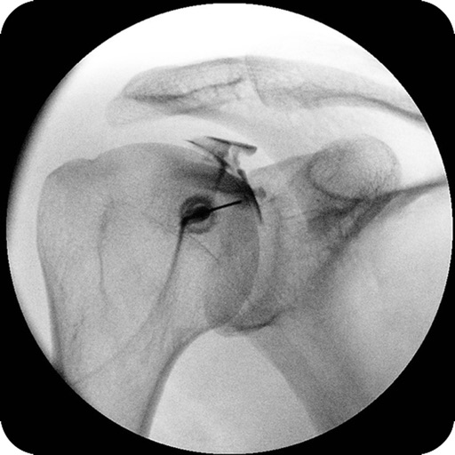 arthroguide