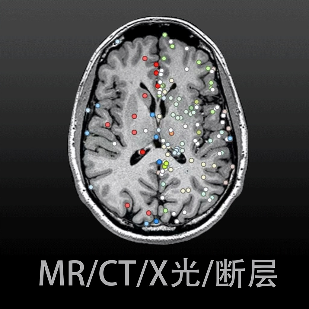 影像解剖图谱-断层·CT·MR·造影·X线·DICOM阅片