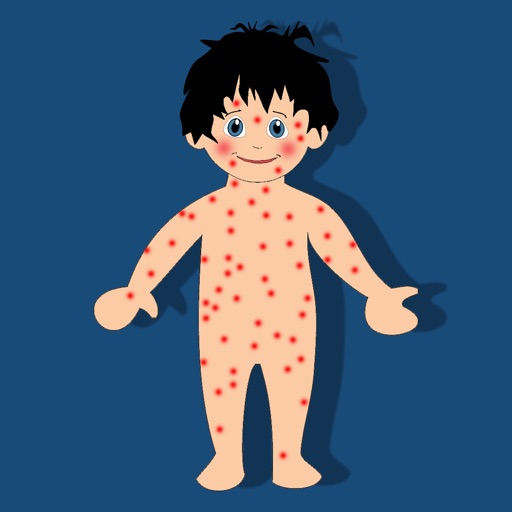 rash
